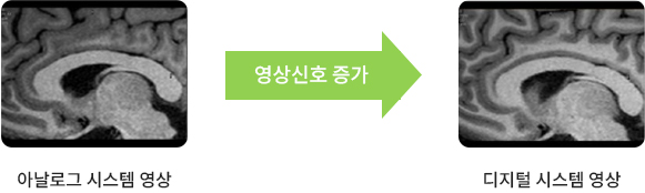 PREMIUM DIGITAL MRI 사진