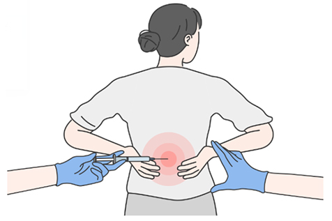 신경차단술 사진