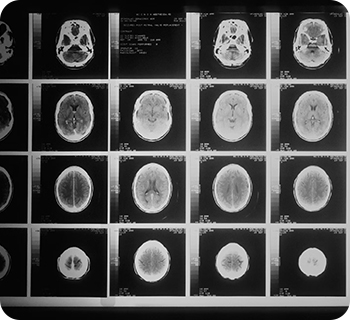 신경외과 특징 이미지 1