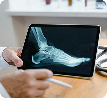 정형외과 특징 이미지 1